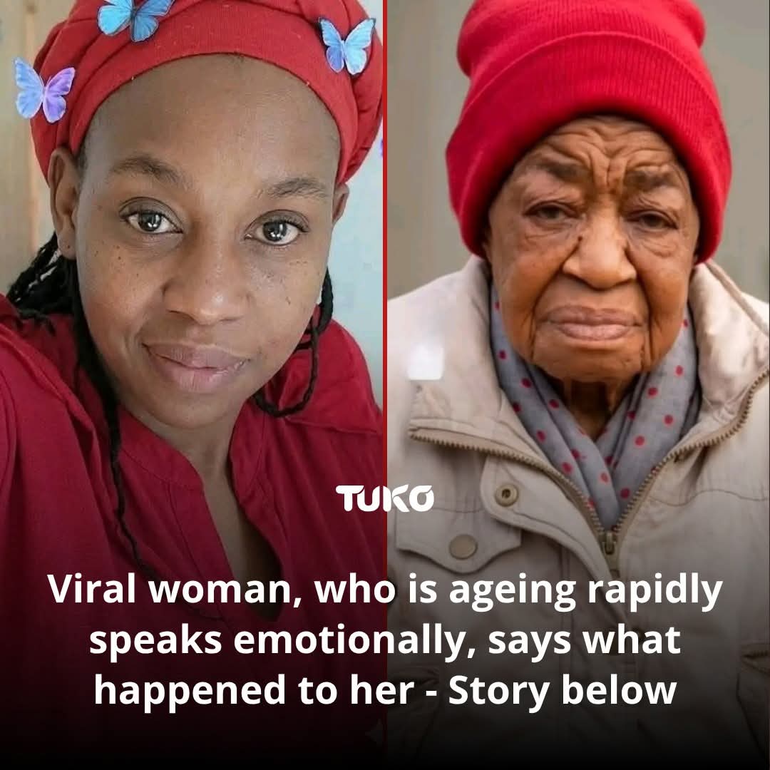 31-Year-Old South African Woman Battles Rare Rapid Ageing Condition — Her Story Has Moved Thousands